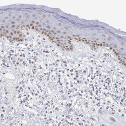 Melanotransferrin/CD228/MFI2 Antibody, Novus Biologicals:Antibodies:Primary